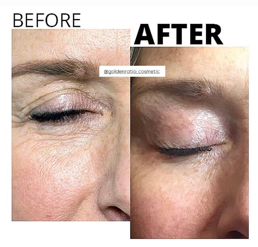 Goldenratio cosmetic - Bild 2